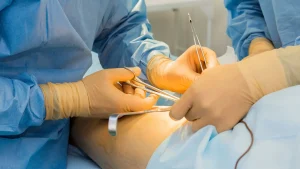 İstanbulda En İyi Tüp Mide Ameliyatı Yapan Doktor